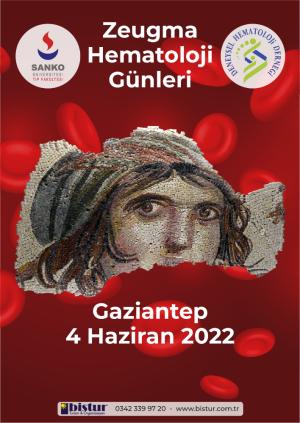 04 HAZİRAN 2022   GAZİANTEP  SANKO ÜNİVERSİTESİ TIP FAKÜLTESİ  ZEUGMA HEMATOLOJİ GÜNLERİ BİLİMSEL PROGRAM 2022